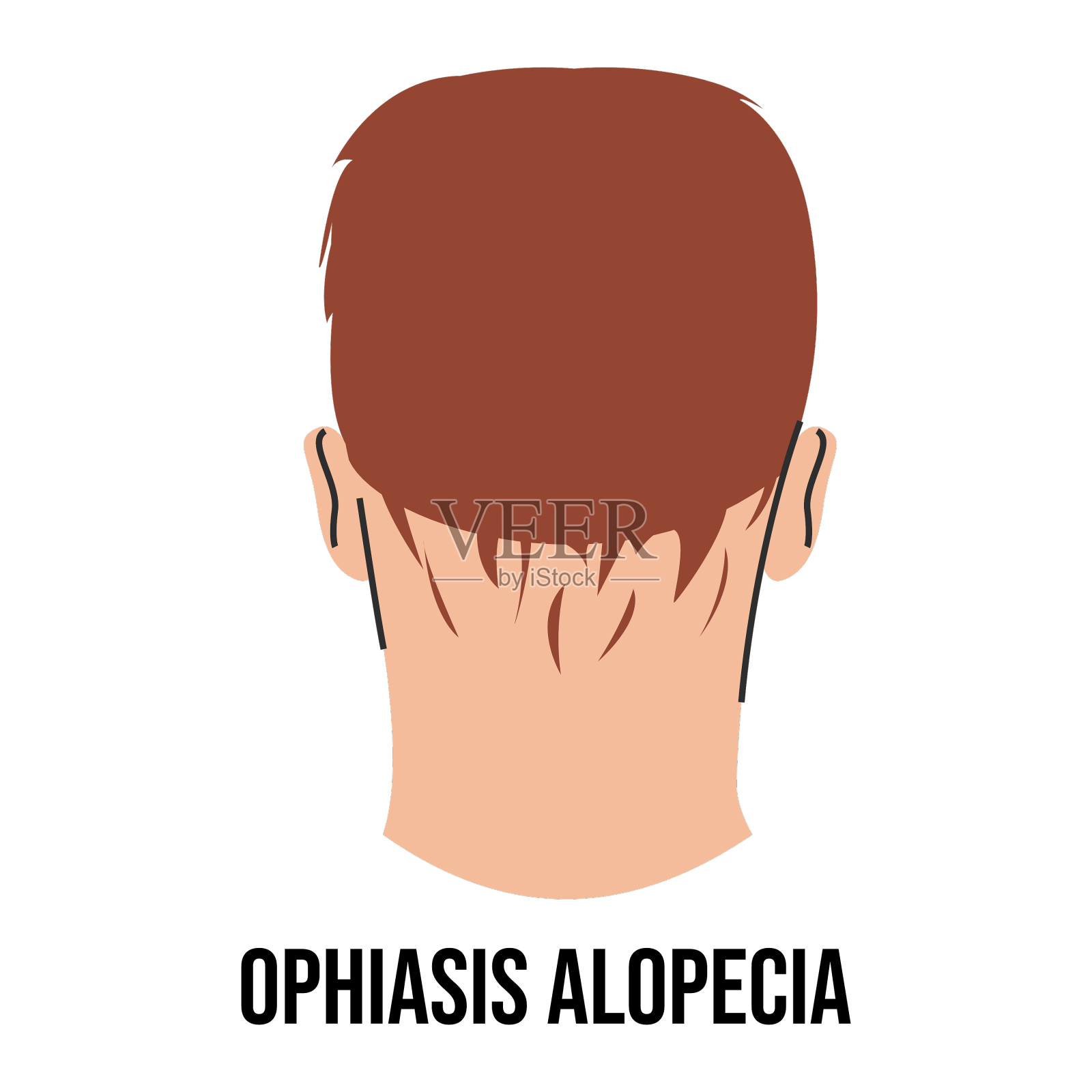 孤立性斑秃病设计元素图片