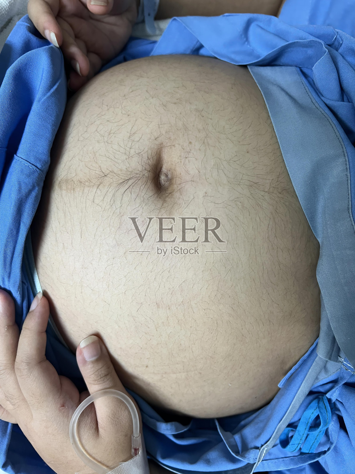 一个人躺在医院的病床上，胃里插着一根管子。照片摄影图片