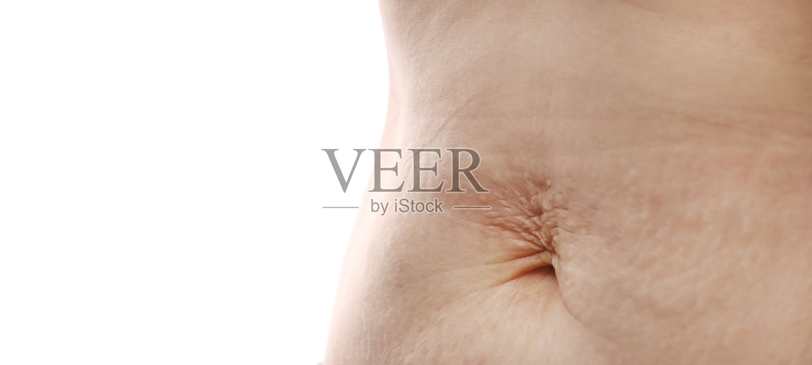 孕妇腹部的特写显示妊娠纹，下腹皮肤松弛，怀孕后婴儿出生后她肥胖，工作室隔离在白色背景上，健康的腹部超重多余的身体概念照片摄影图片