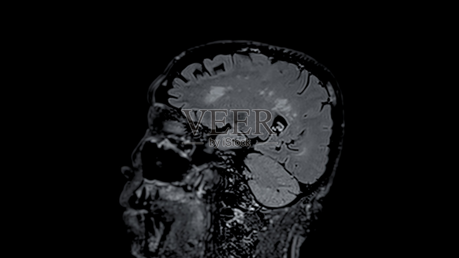 MRI大脑扫描矢状面提供了对大脑有价值的见解照片摄影图片