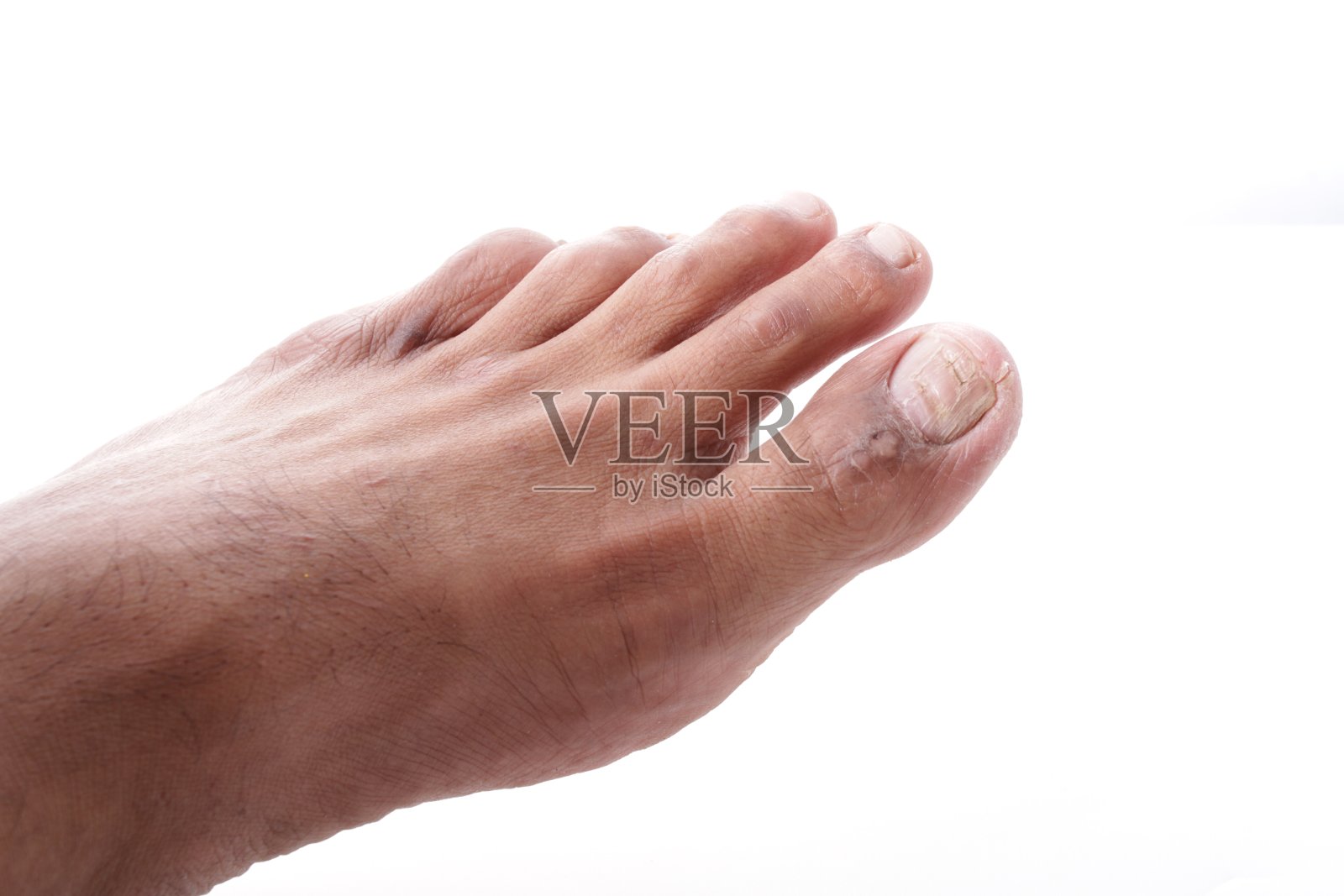 疣照片摄影图片