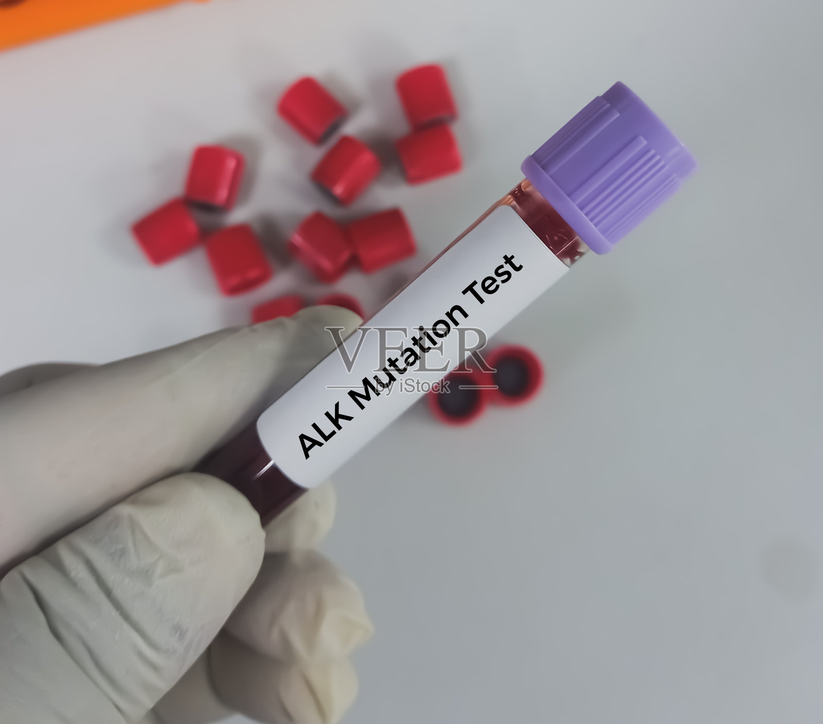 血样进行ALK(间变性淋巴瘤激酶)检测，ALK突变分析。照片摄影图片