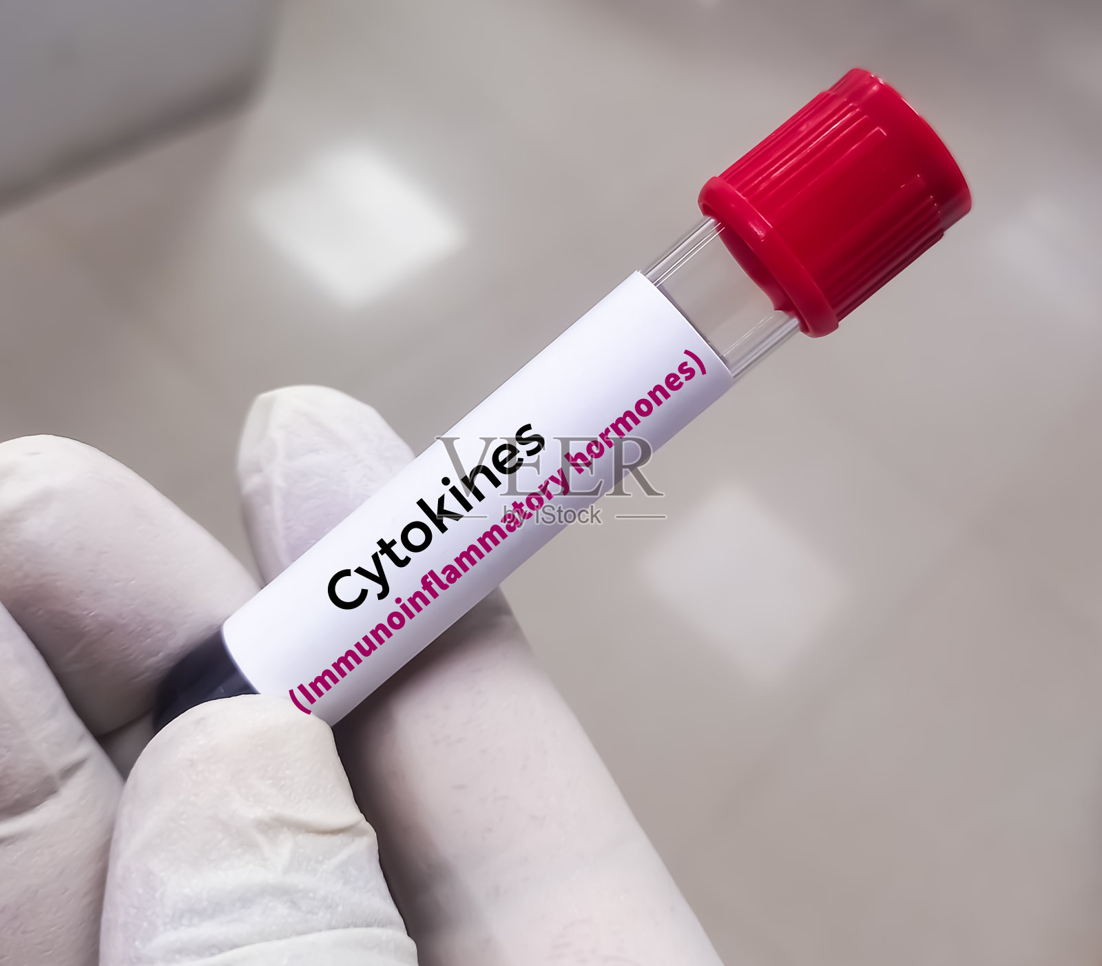 用于细胞因子检测的血液样本，用于免疫、感染或炎症性疾病的病理生理学研究：细胞因子释放综合征照片摄影图片
