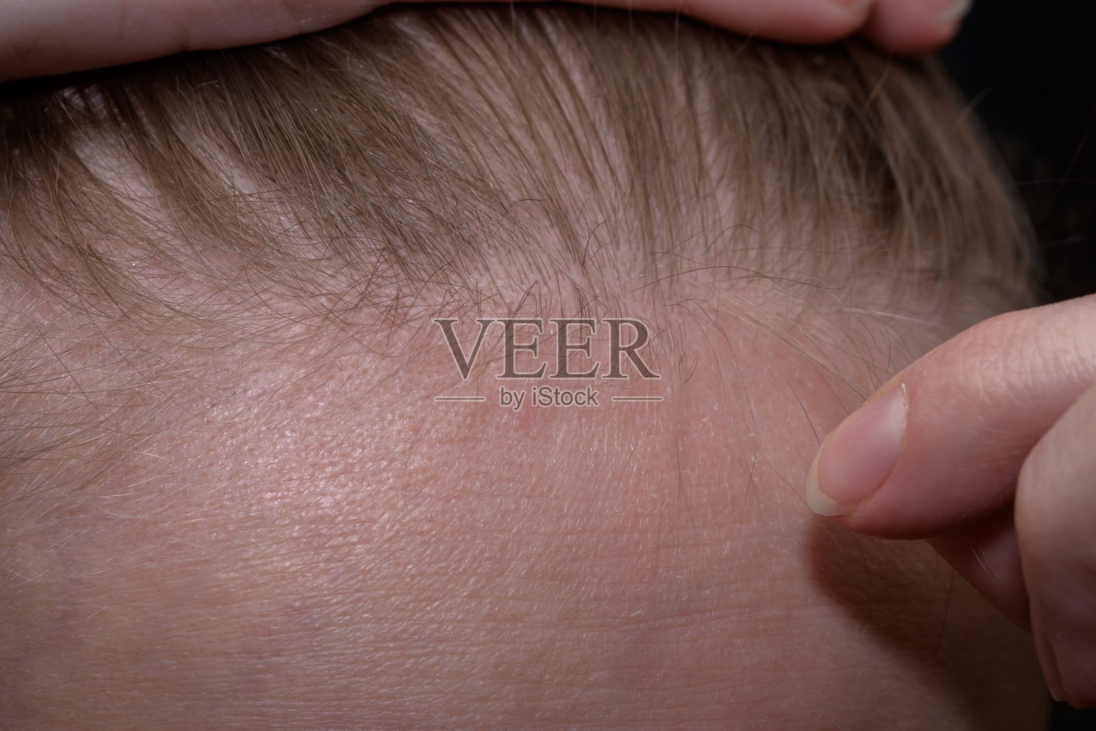 婴儿的头发，前额线上长出的新头发照片摄影图片