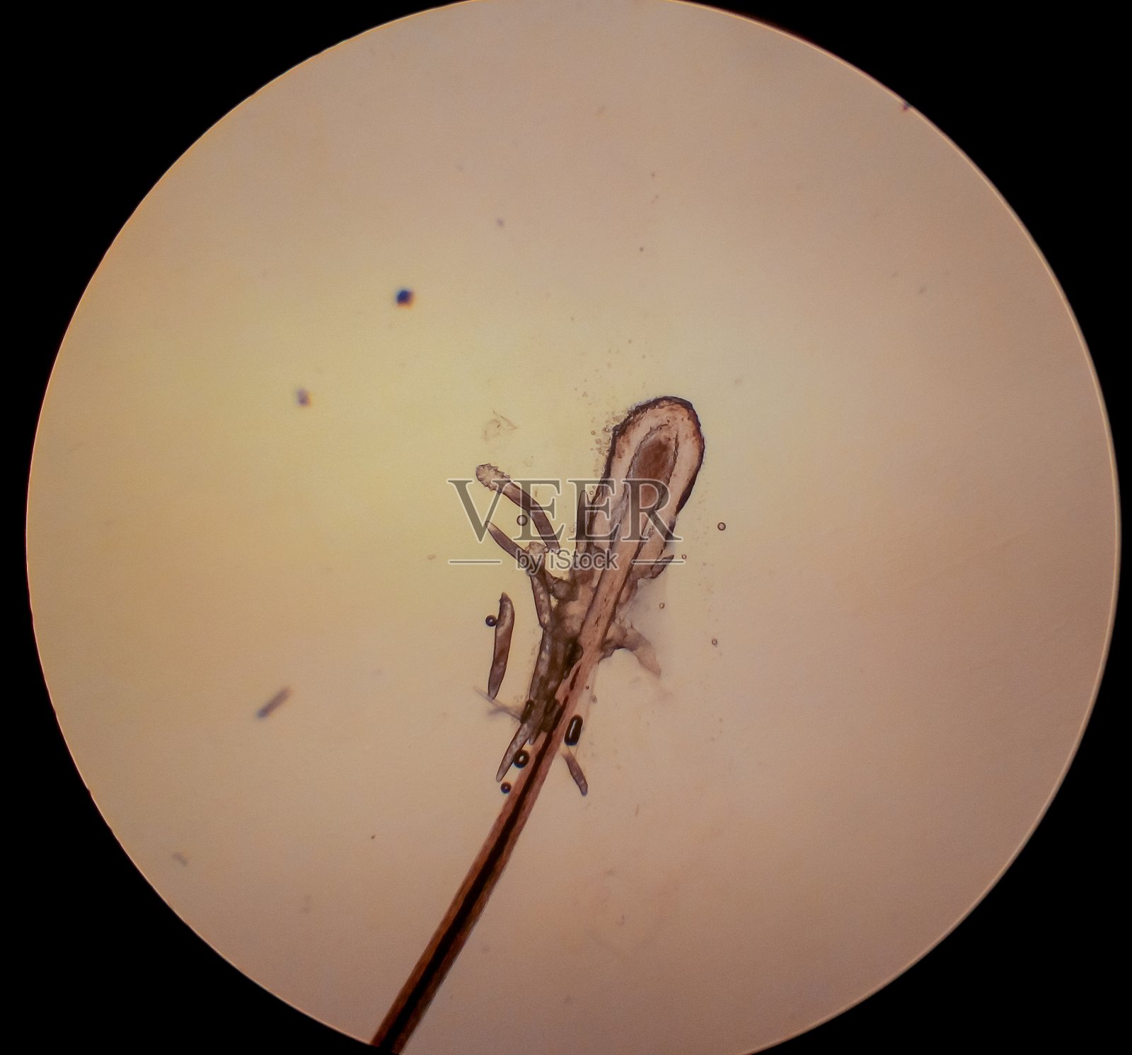 毛囊蠕形螨-人类眼睛睫毛上的寄生螨照片摄影图片