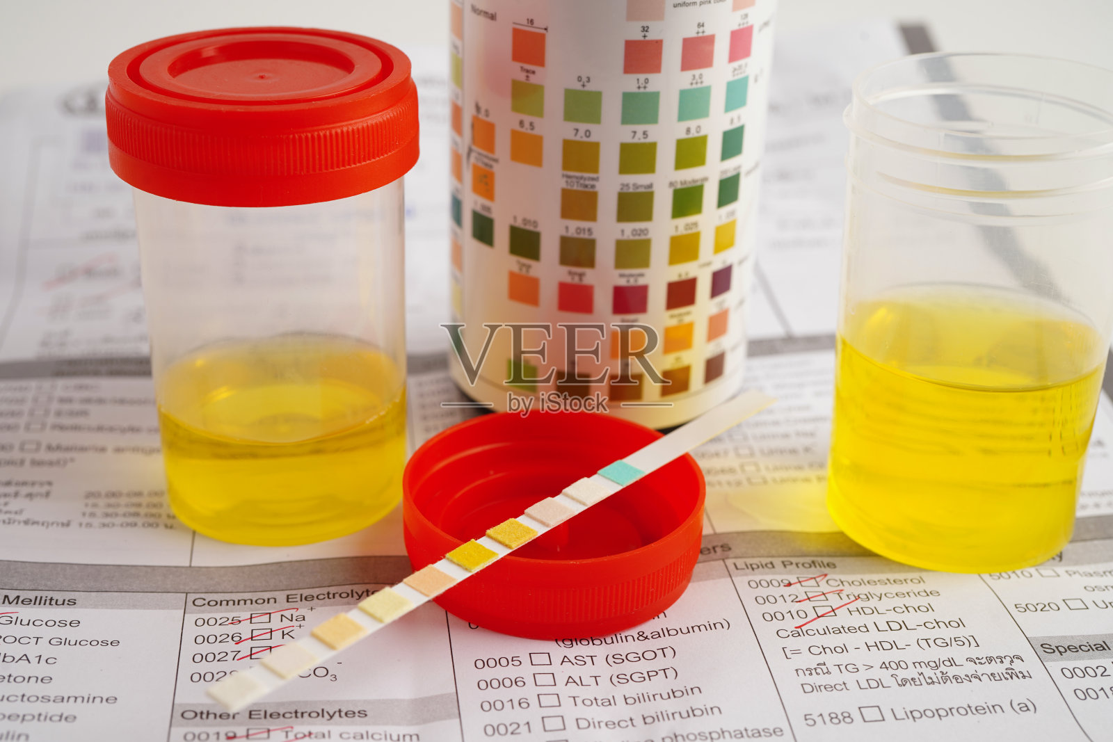 尿液分析，尿杯与试剂条pH纸测试和对比图在实验室。照片摄影图片