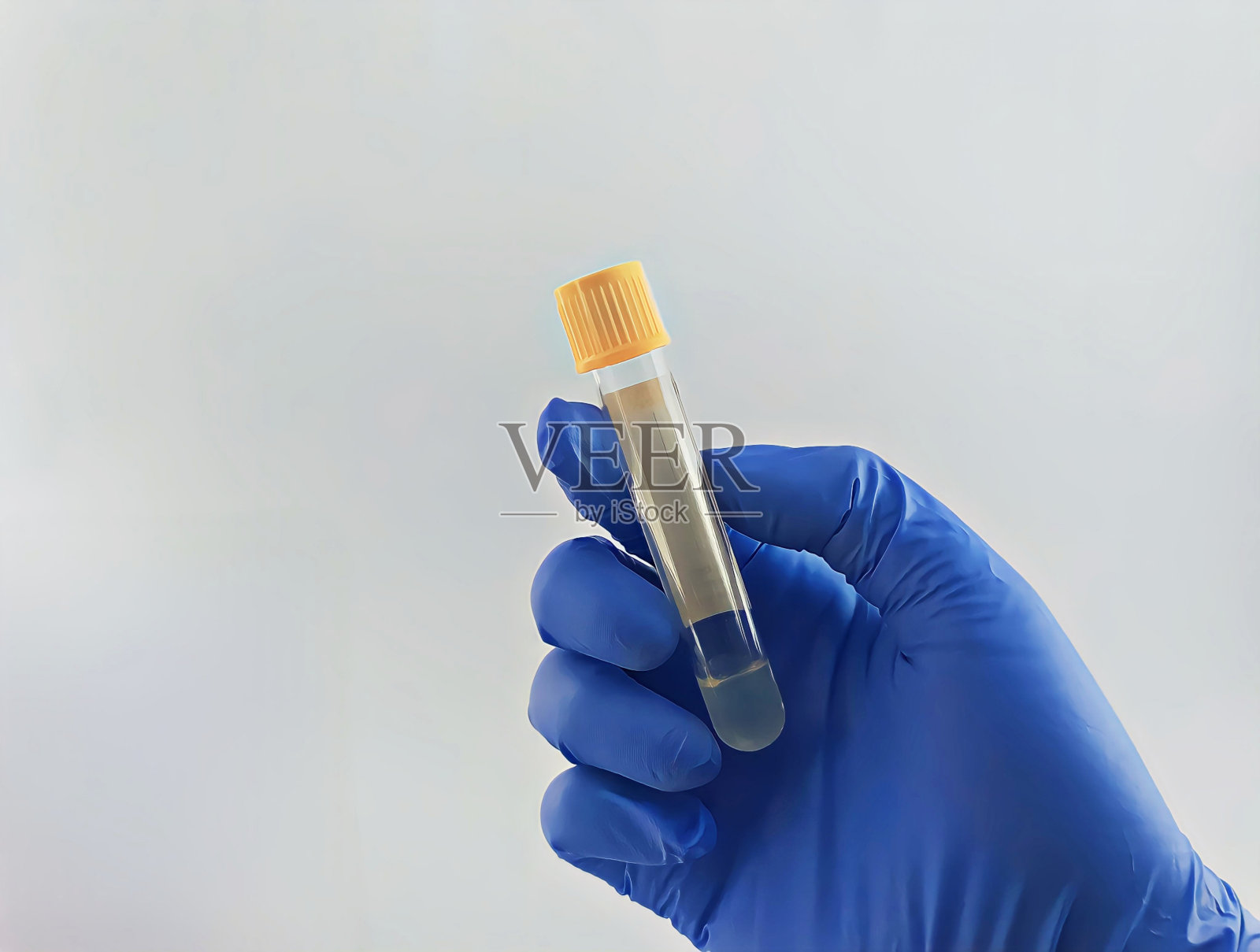 用于采集的真空管和实验室用白色背景的蓝色手套中的血液样本照片摄影图片