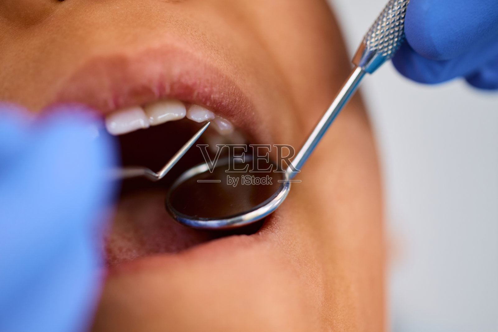 小女孩接受牙医检查牙齿的特写。照片摄影图片