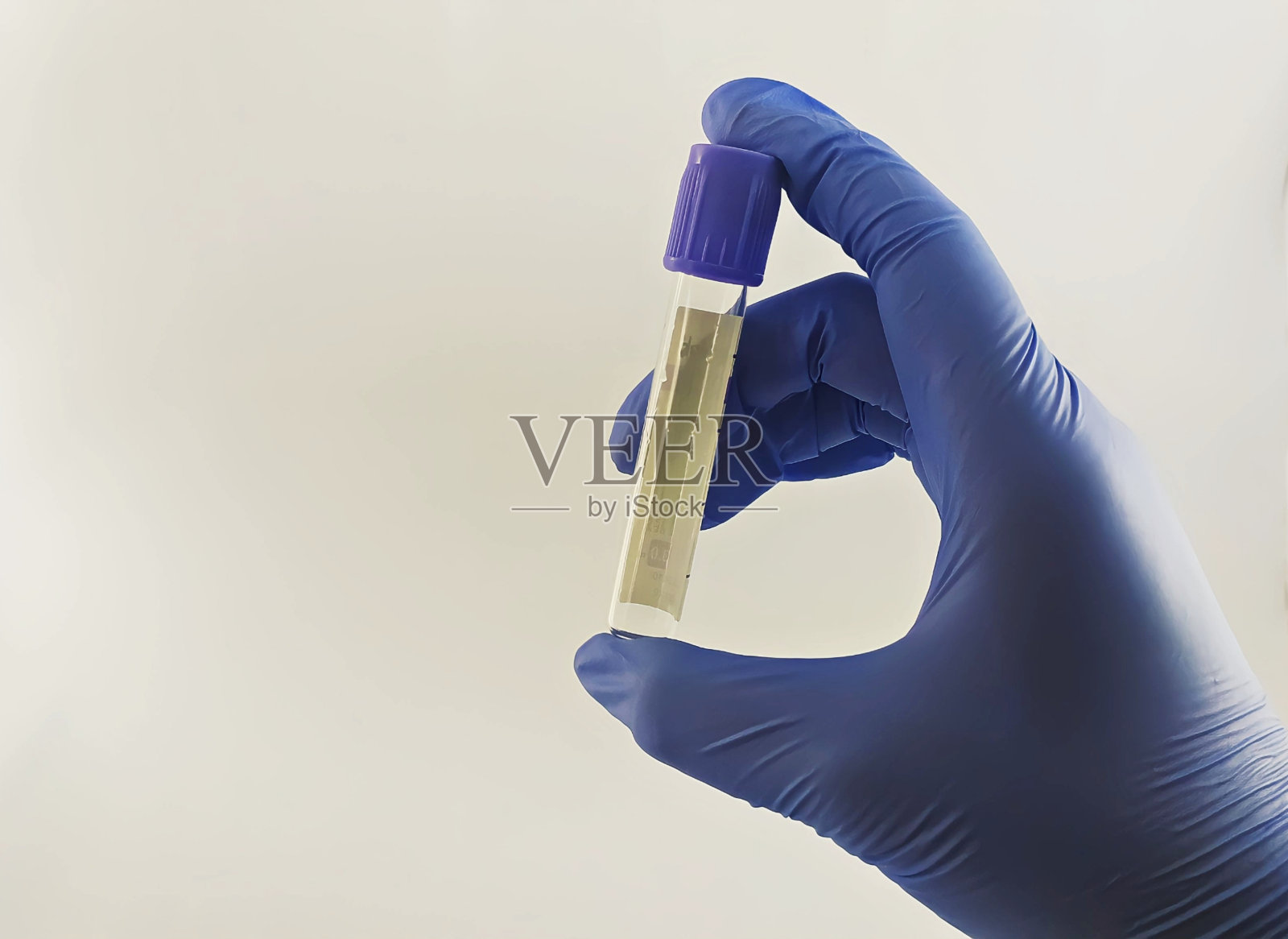 用来诊断疾病的医用输血管照片摄影图片