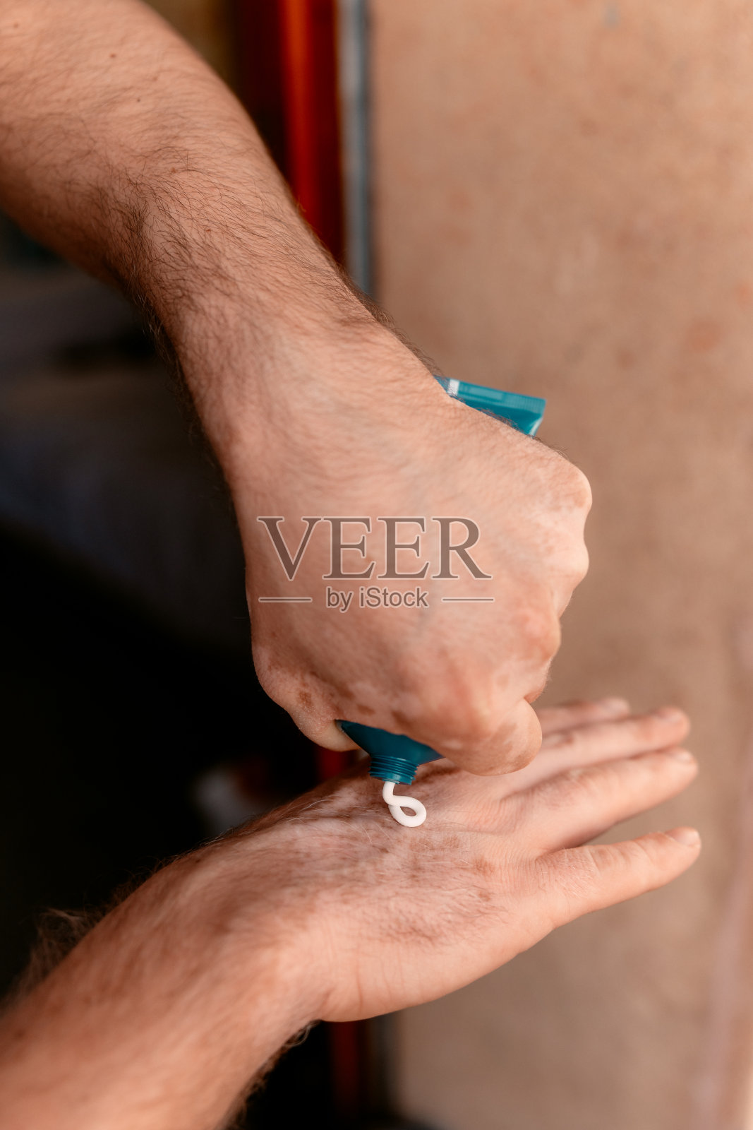 男性用手治疗皮肤状况的特写。治疗白癜风的药物照片摄影图片