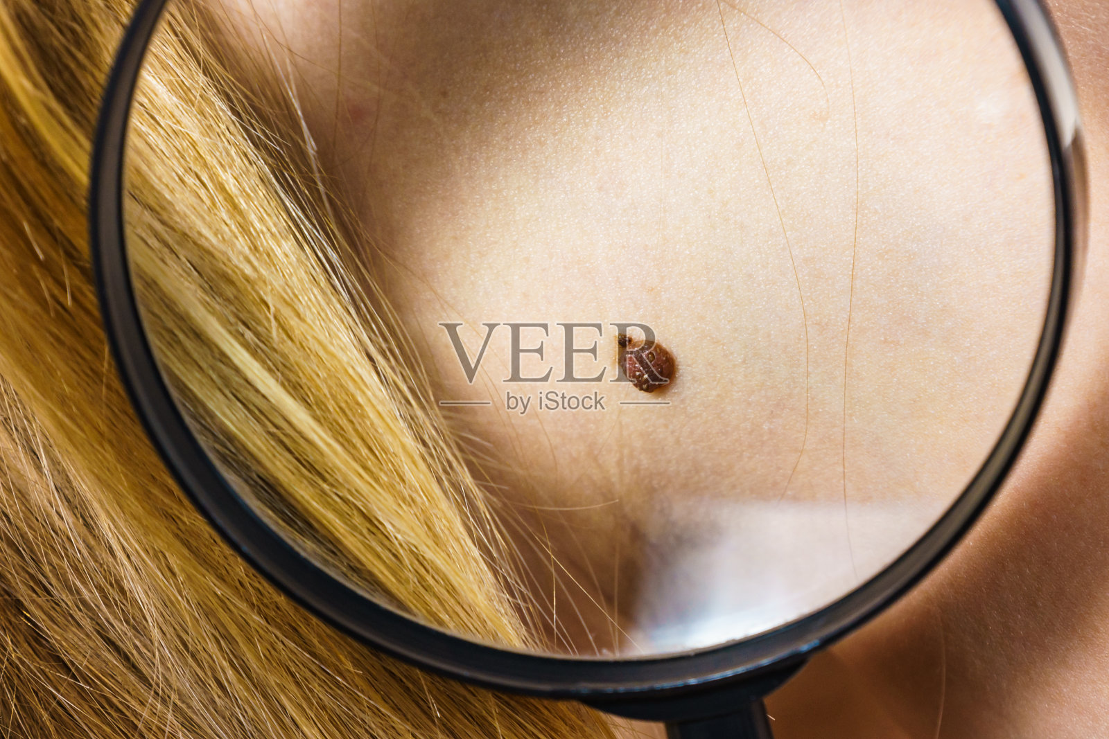 特写皮肤上的棕色痣。照片摄影图片