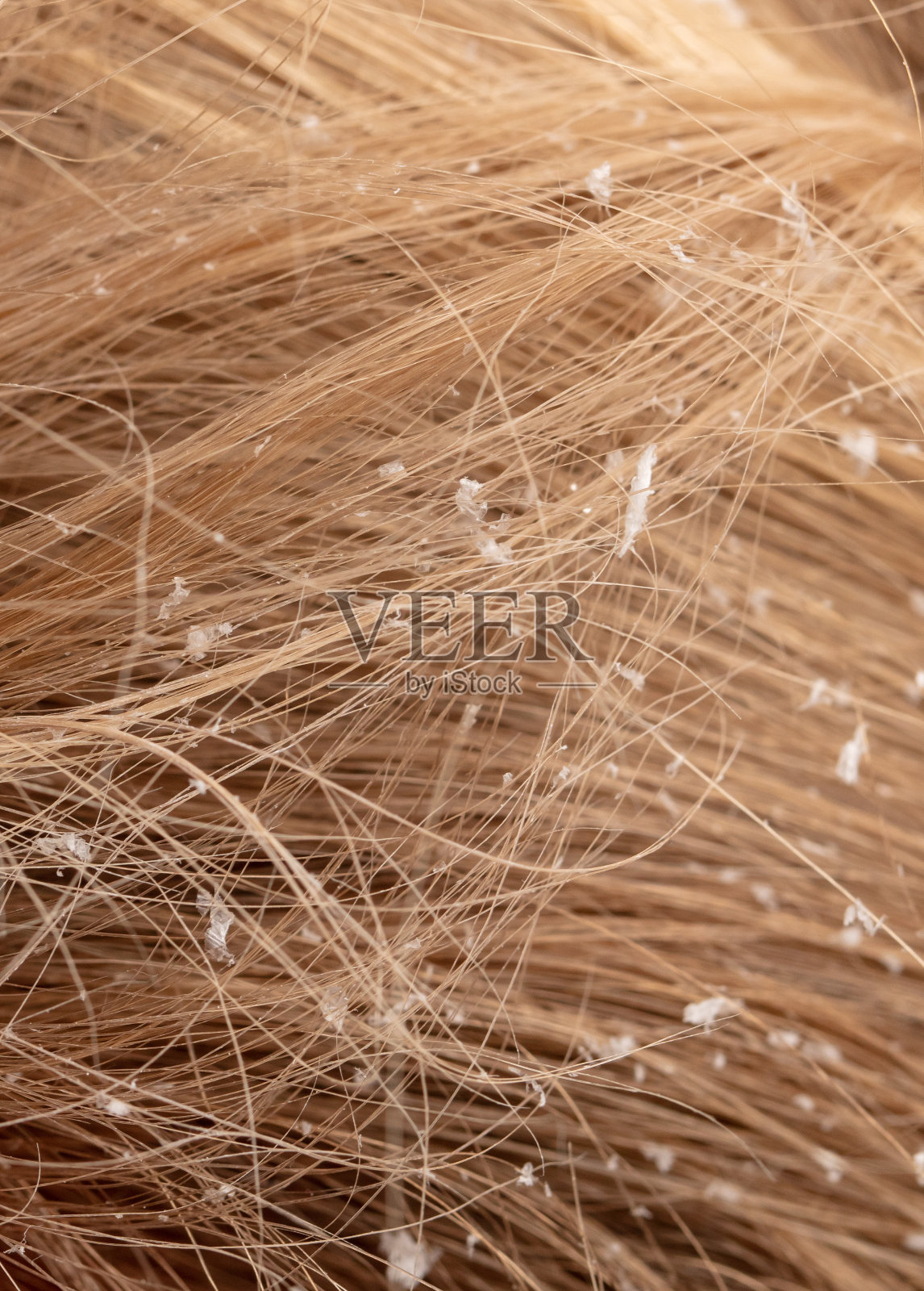 白色的雪花落在金发女郎的头发上。宏照片摄影图片