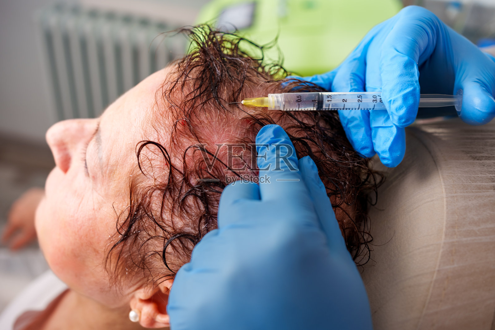 头发消脂照片摄影图片