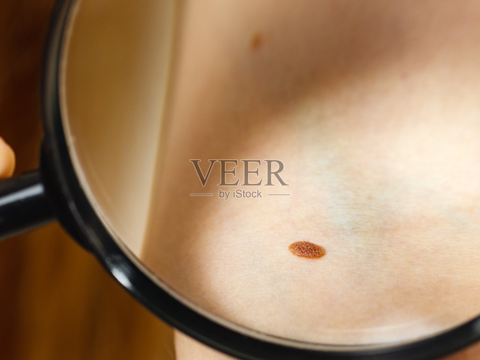 特写皮肤上的棕色痣。照片摄影图片