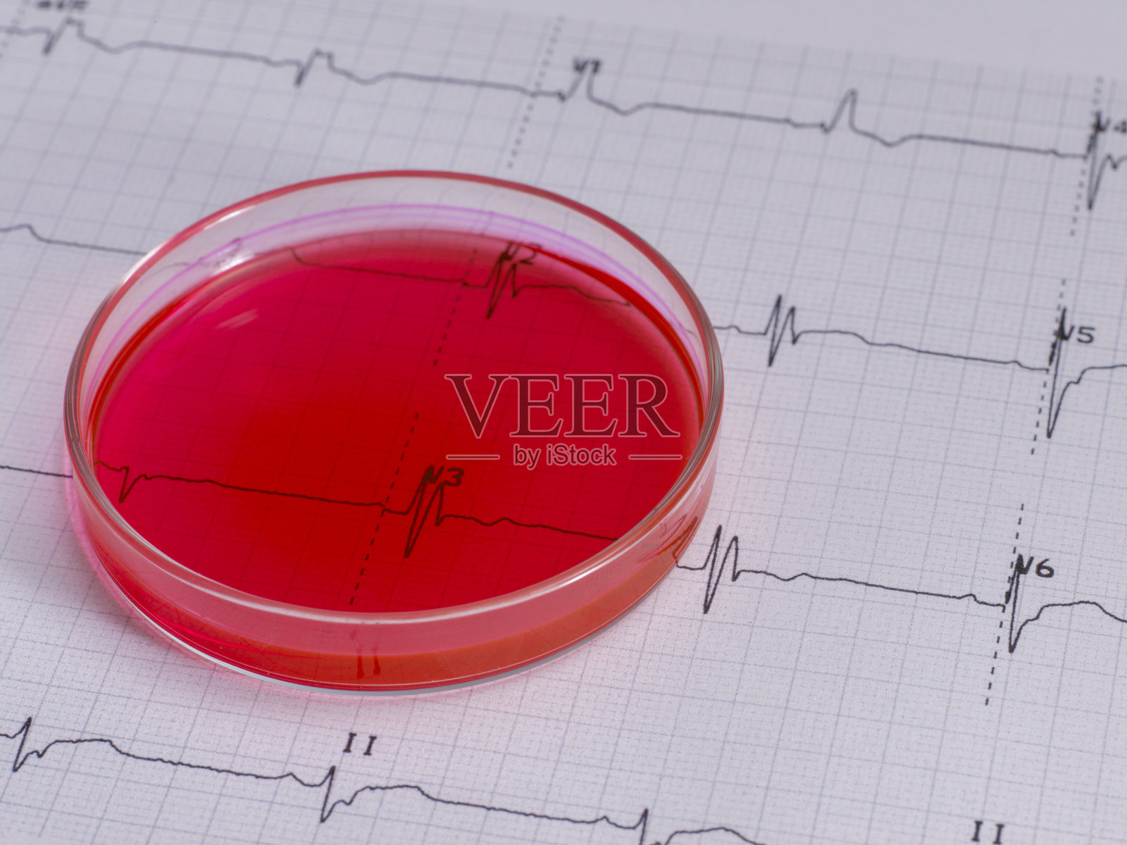 真实心电图和新型冠状病毒血试管没有人。照片摄影图片
