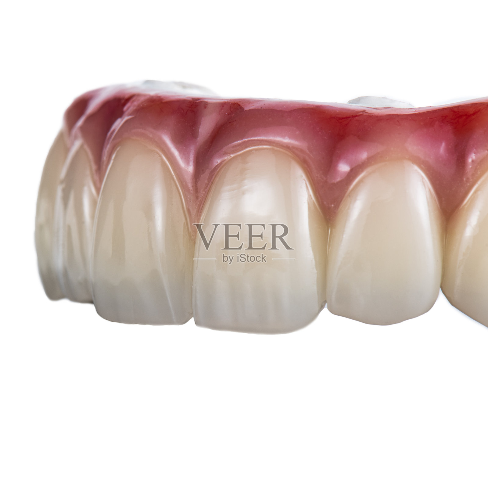 8颗植体的锆石桥照片摄影图片