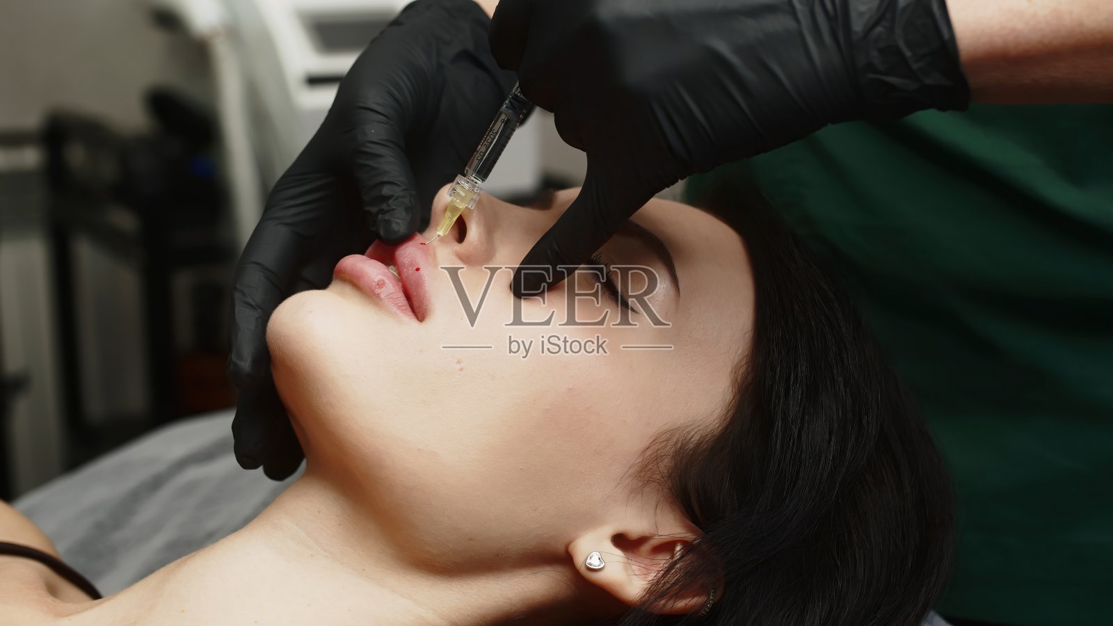 一名外科医生戴着医用手套，小心翼翼地用注射器将透明质酸注入一名妇女的嘴唇。丰唇手术。注射美容。照片摄影图片