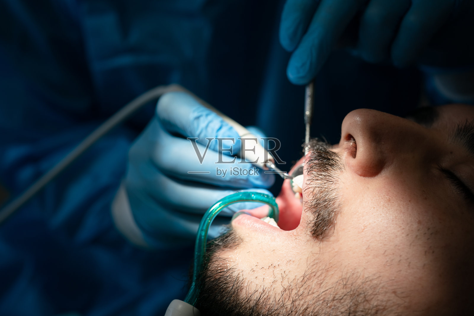 医护人员，在诊所清洁病人牙齿时，靠近牙医的手照片摄影图片