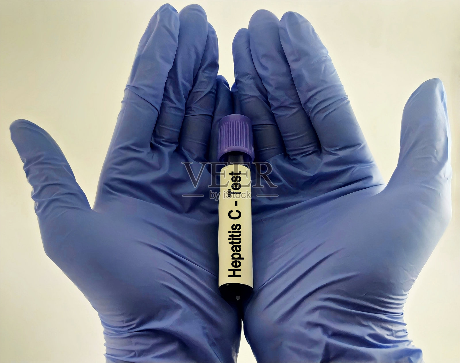 科学家或医务工作者手持血液样本进行丙型肝炎病毒检测照片摄影图片