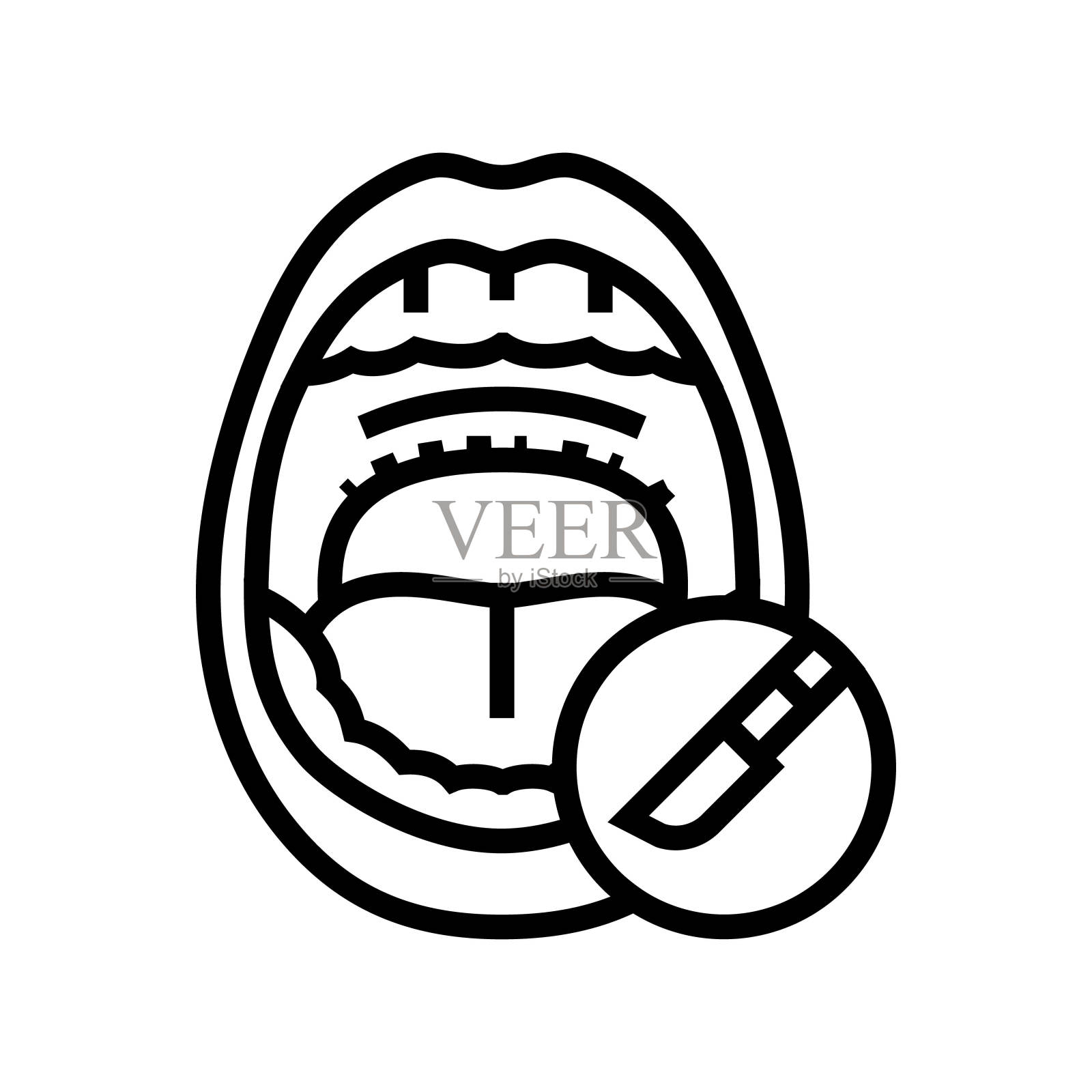 悬雍垂腭咽成形术线图标矢量插图插画图片素材