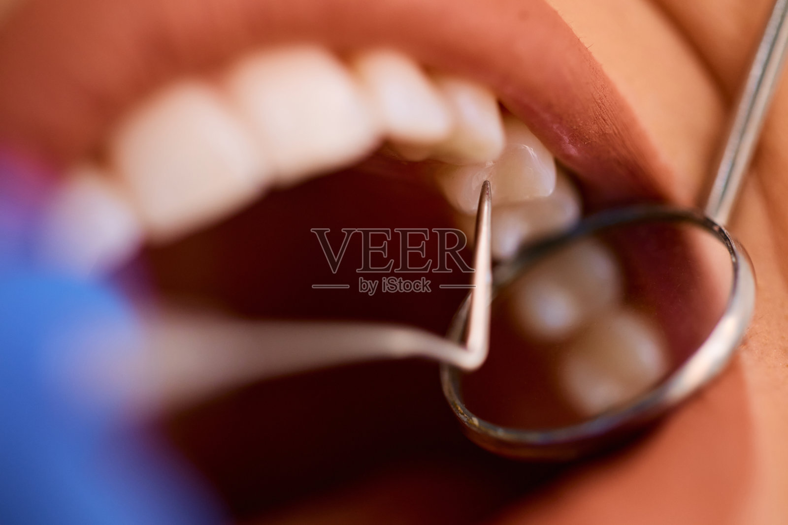 在牙科诊所接受牙齿检查的妇女近照。照片摄影图片