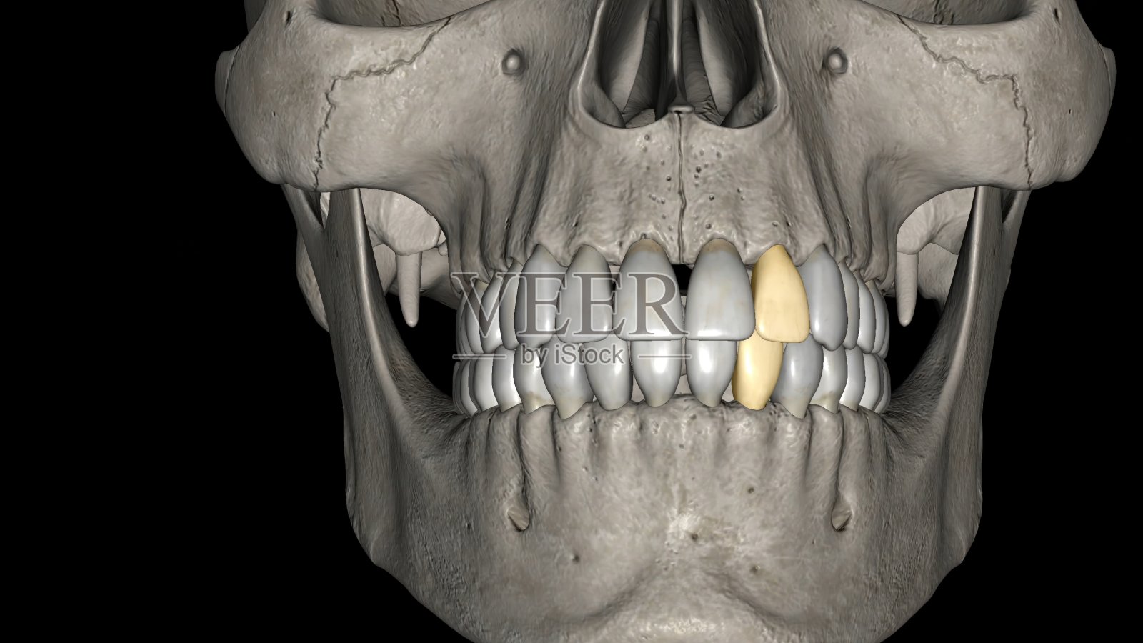 侧切牙，上颌和下颌照片摄影图片