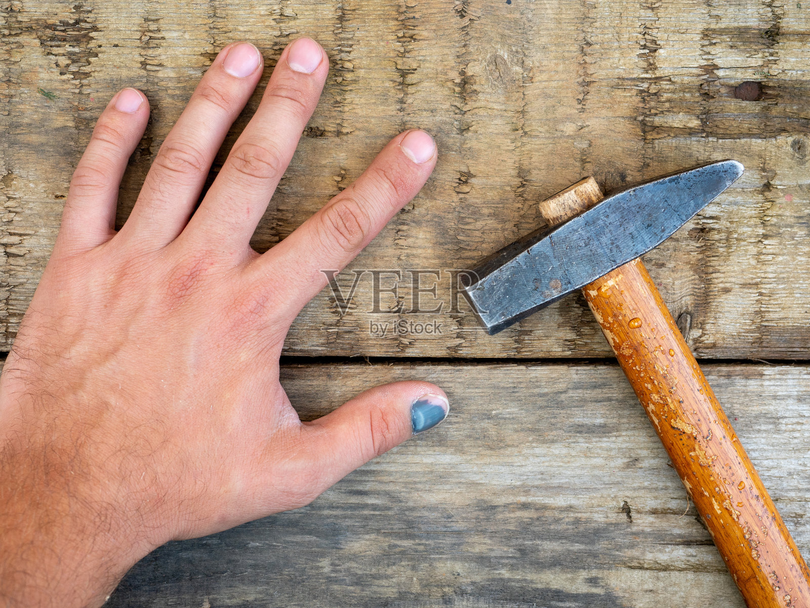 一个工人的特写镜头没有击中他的拇指。血肿，淤青，淤青。草在工作。保险。俯视图，平铺照片摄影图片