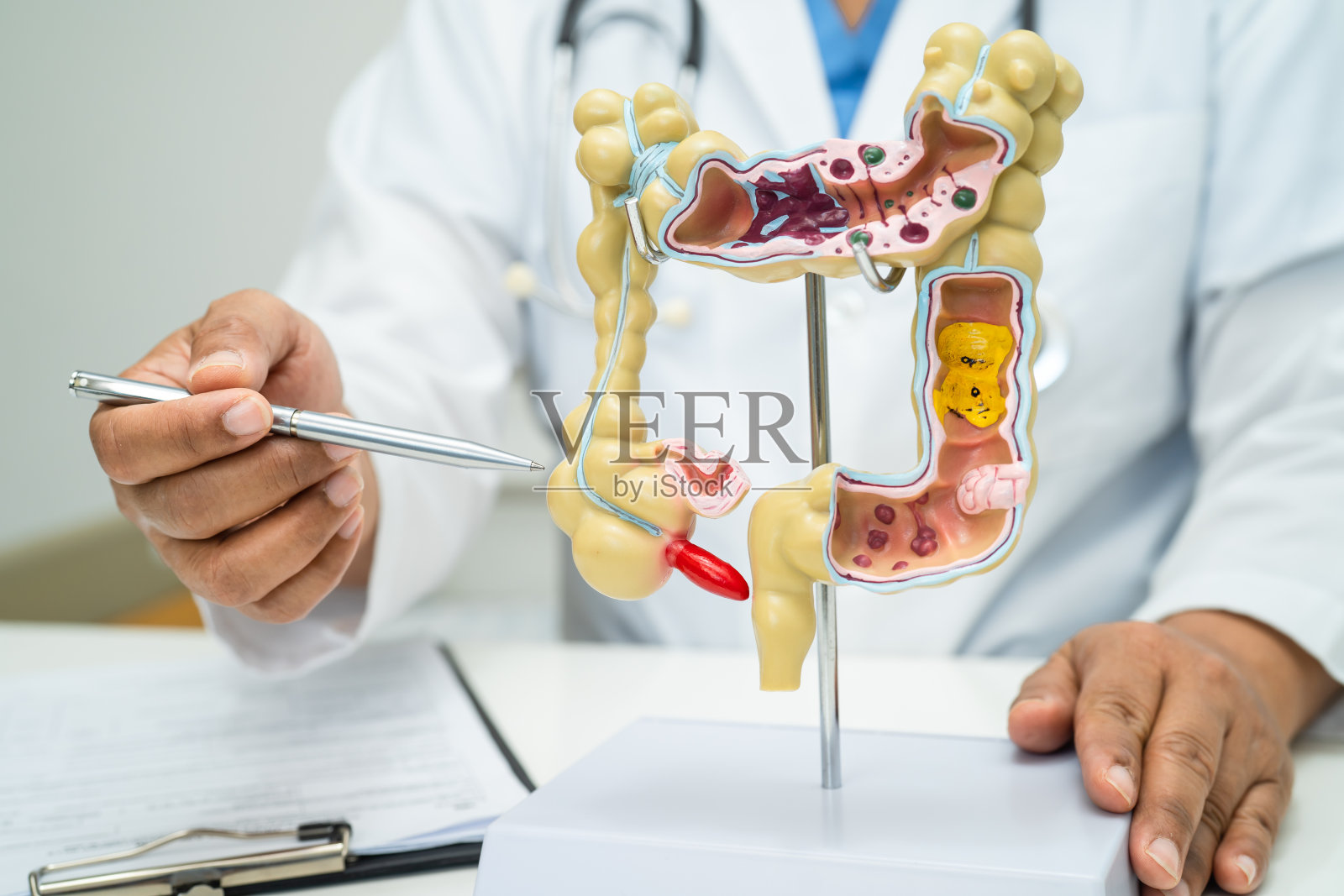 肠、阑尾、消化系统，医生手持解剖模型在医院进行研究诊断和治疗。照片摄影图片