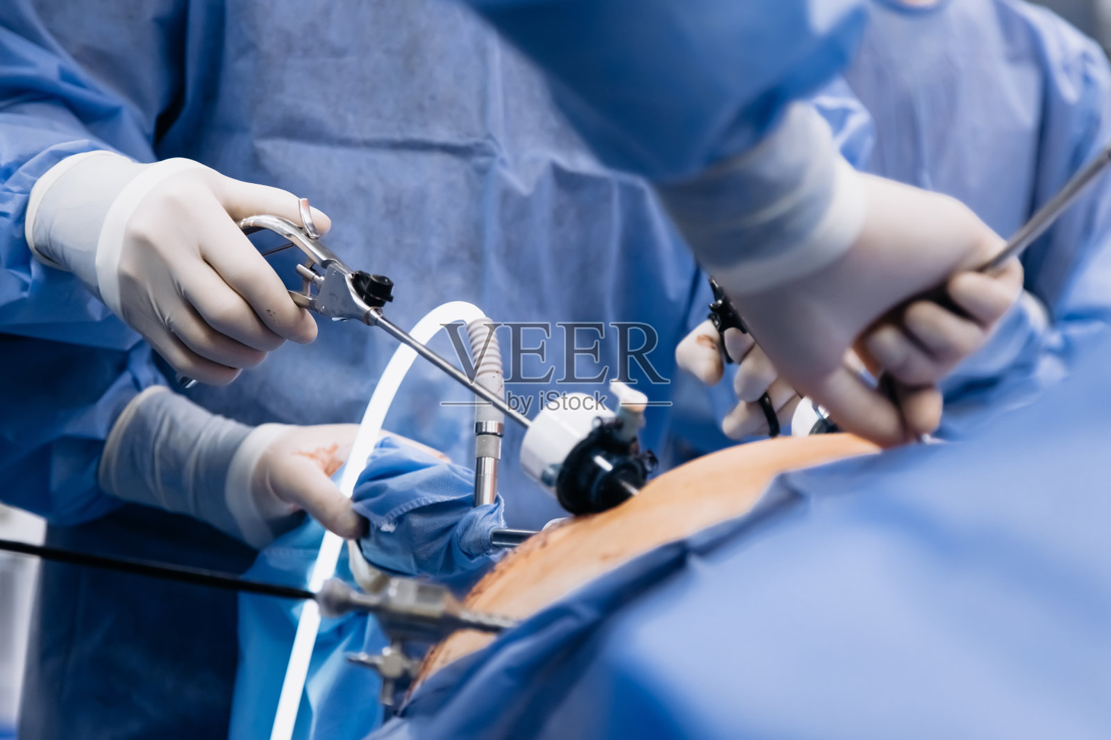 手术室里有专业的外科医生。腹腔镜手术器械。外科医生在手术室里进行腹腔镜胃手术。照片摄影图片