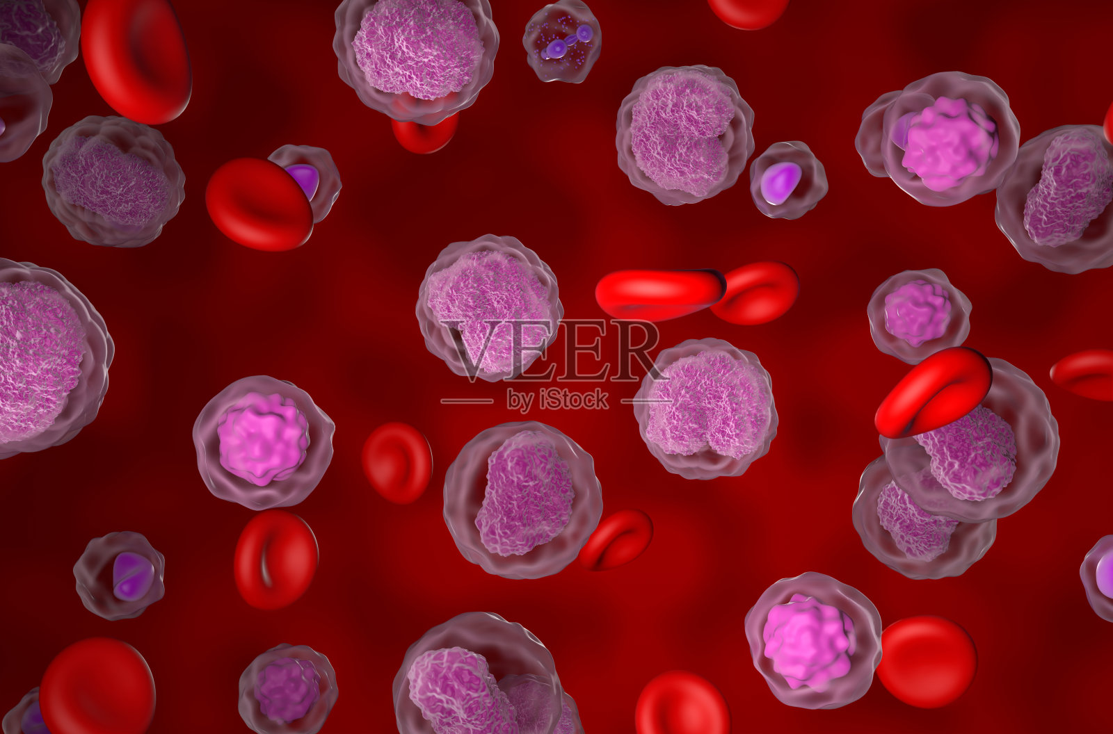 血流中的非霍奇金淋巴瘤(NHL)细胞-等距视图三维图照片摄影图片