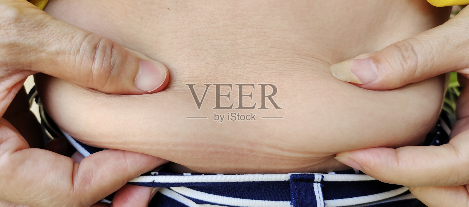 脂肪团和脂肪，超重和宽松的腰围。照片摄影图片