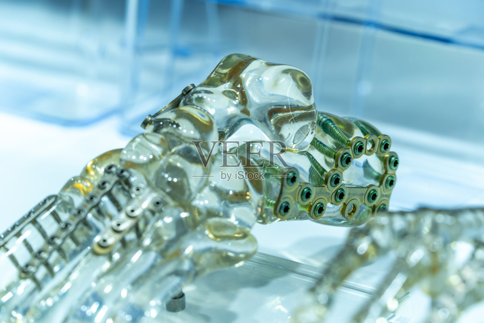 透明骨模型骨折固定工具近照。照片摄影图片