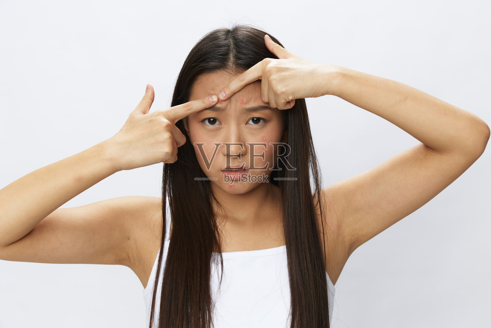 亚洲女性面部皮肤问题，痤疮和炎症，红疹和过敏，水痘，悲伤的皮疹。面部皮肤护理概念，针对疾病和神经照片摄影图片