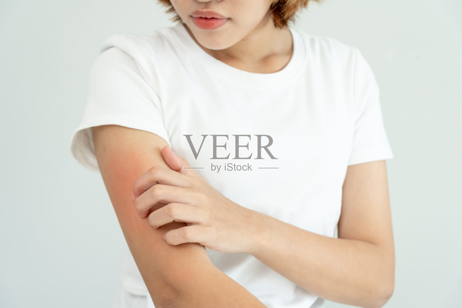 皮肤问题与美容。年轻女性抓挠身体有皮肤过敏引起的皮肤瘙痒、类固醇过敏、敏感皮肤、晒伤引起的皮肤发红、化学过敏、皮疹、昆虫叮咬、脂溢性皮炎。照片摄影图片