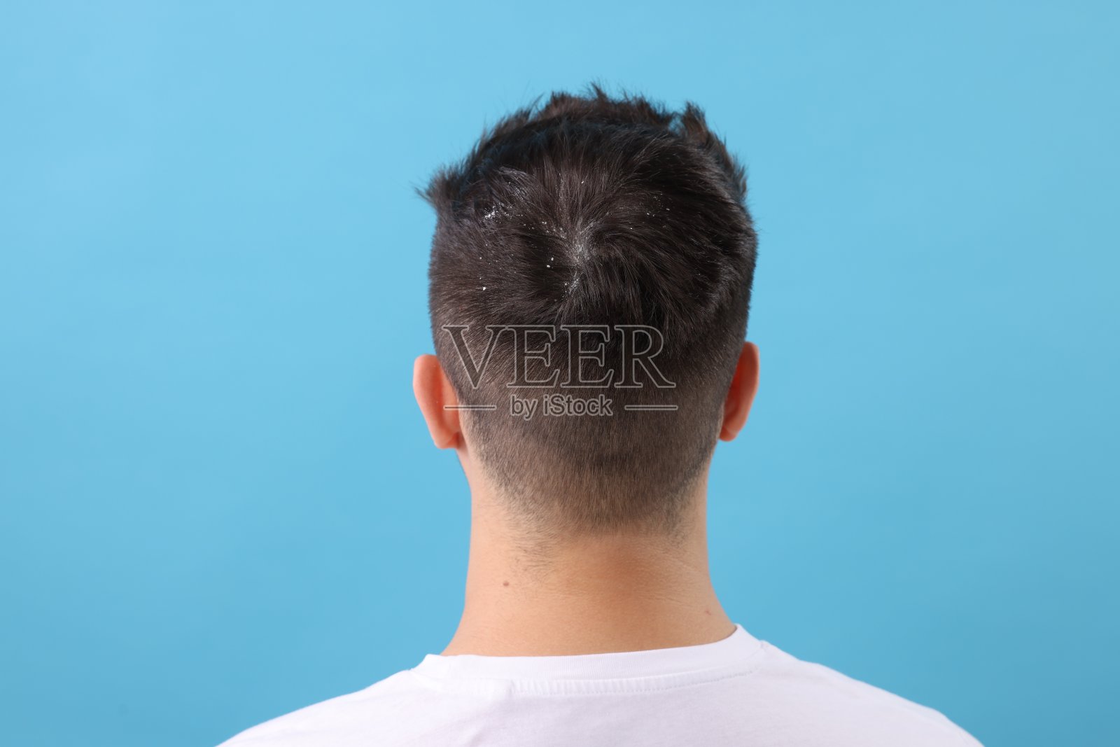 深色头发上有头皮屑的男人，浅蓝色背景，后视图照片摄影图片