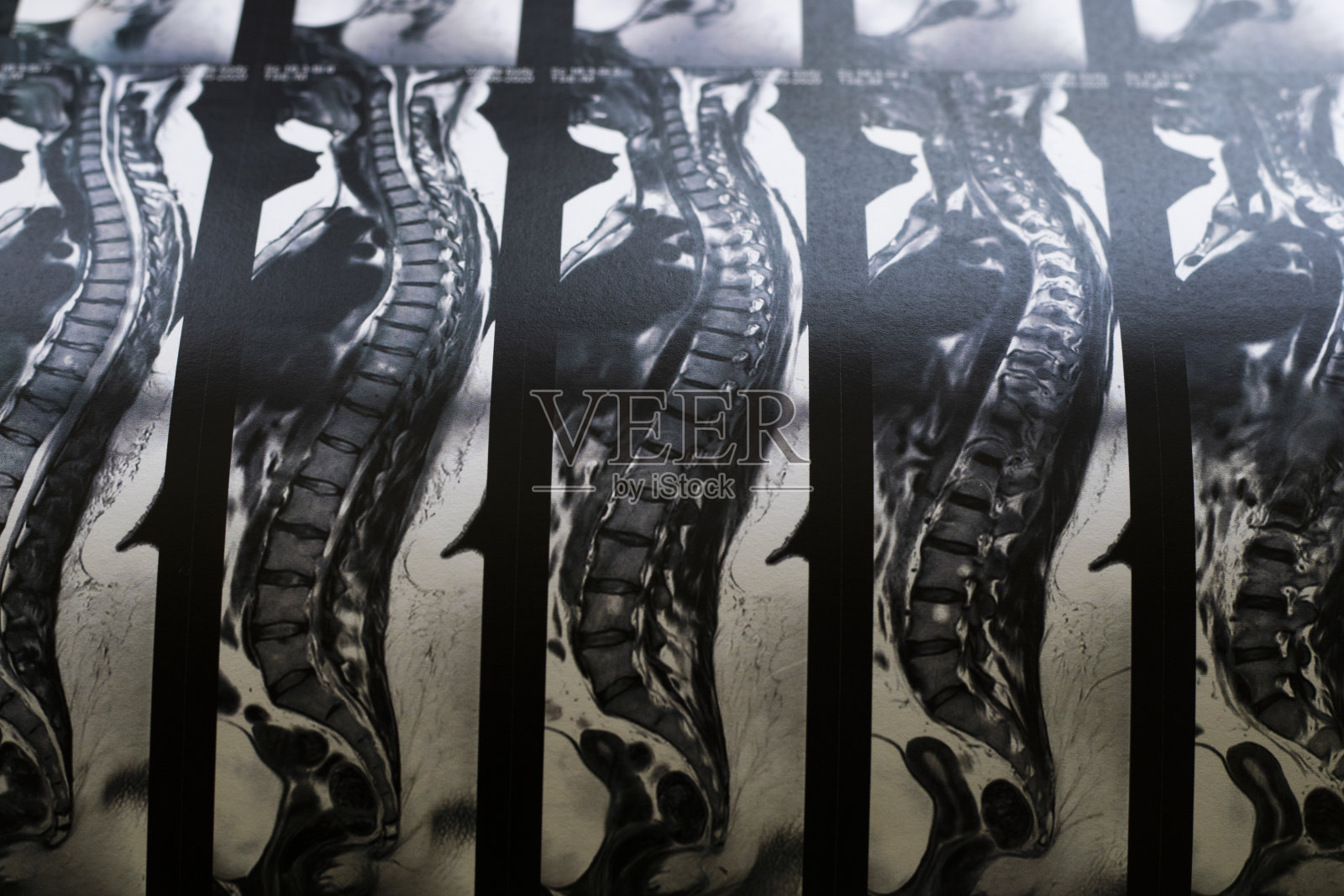 磁性计算机断层扫描照片摄影图片