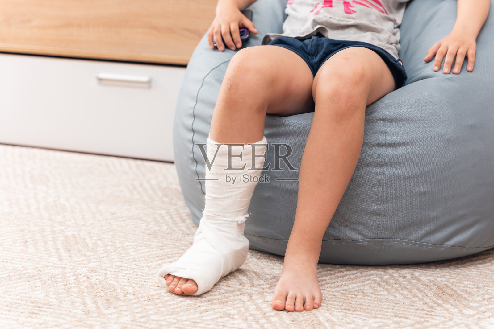 一个打了石膏的断了腿的孩子坐在豆袋椅上照片摄影图片