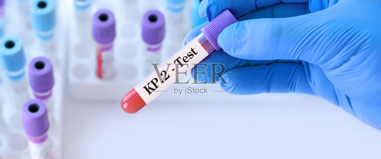 医生拿着检测血液样本的试管为检测病毒KP.2的背景医学试管。KP.2，调情型之一。FLiRT的症状与omicron相同照片摄影图片