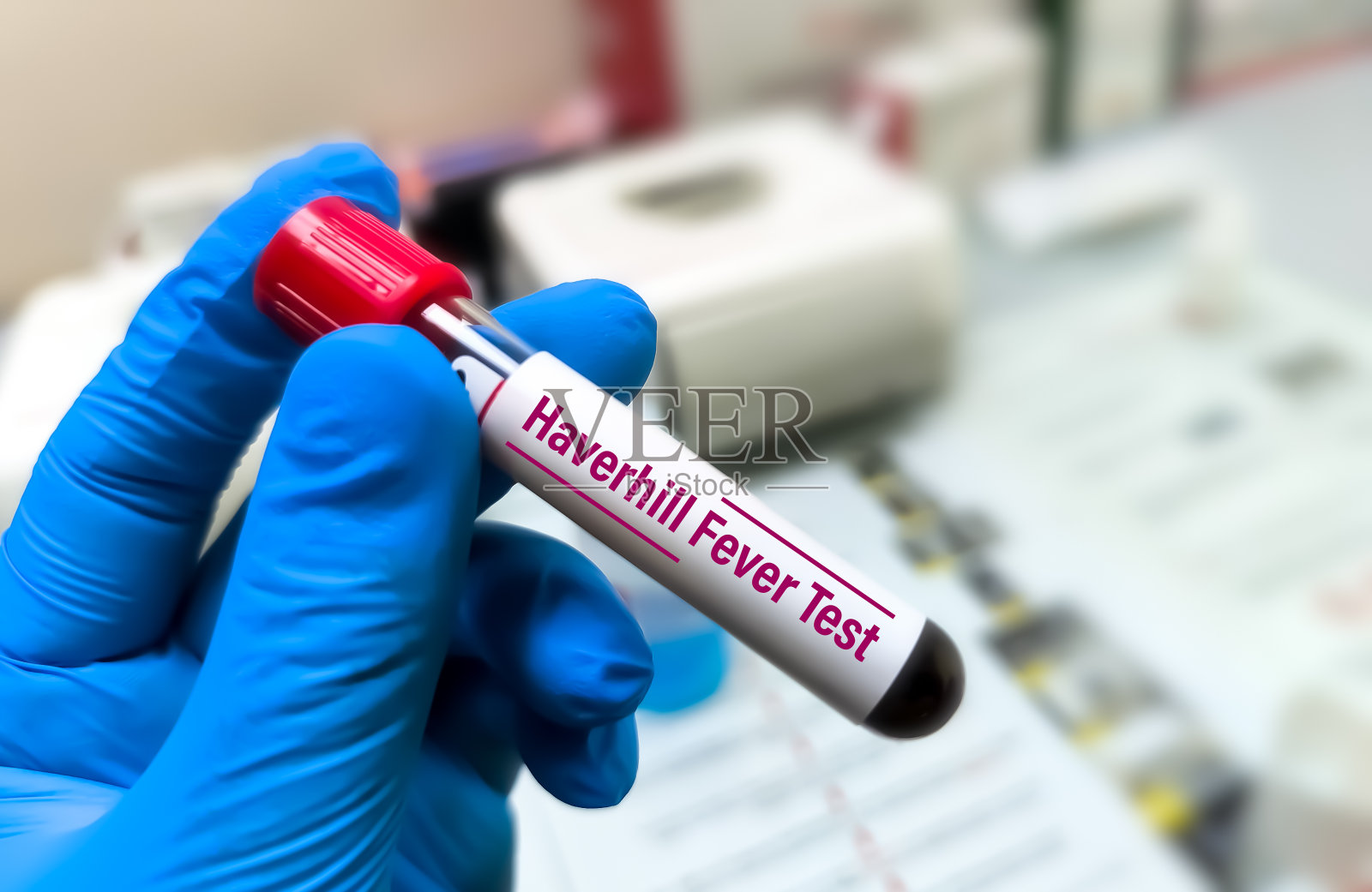 哈弗希尔热(流行性关节炎红斑)是一种由念珠状链杆菌引起的全身性疾病照片摄影图片