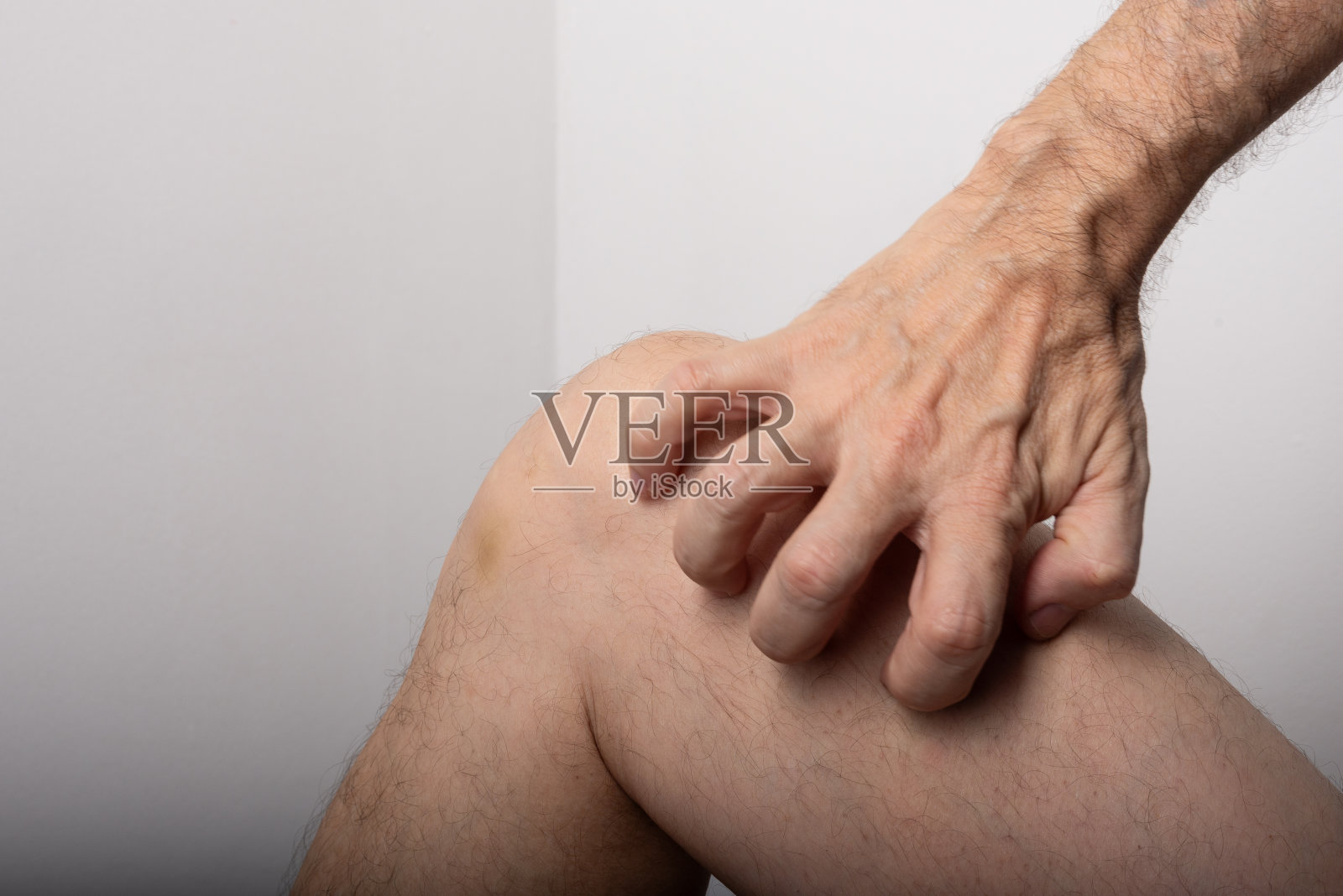 男人在膝盖和腿之间挠痒痒。皮肤疾病。过敏反应。皮肤病。照片摄影图片