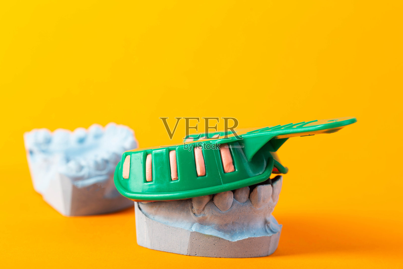 橙色背景上病人蓝色石膏下巴上的绿色牙模托盘。为制造牙冠和假体而对颌骨进行印模的概念。正畸，文本的复制空间照片摄影图片