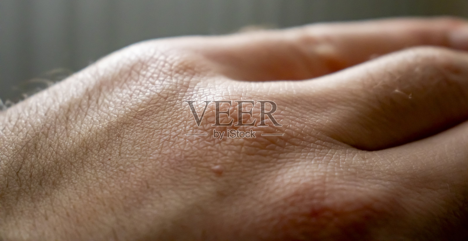 人类的手。男性皮肤类型。皮肤病学背景。健康的皮肤。照片摄影图片