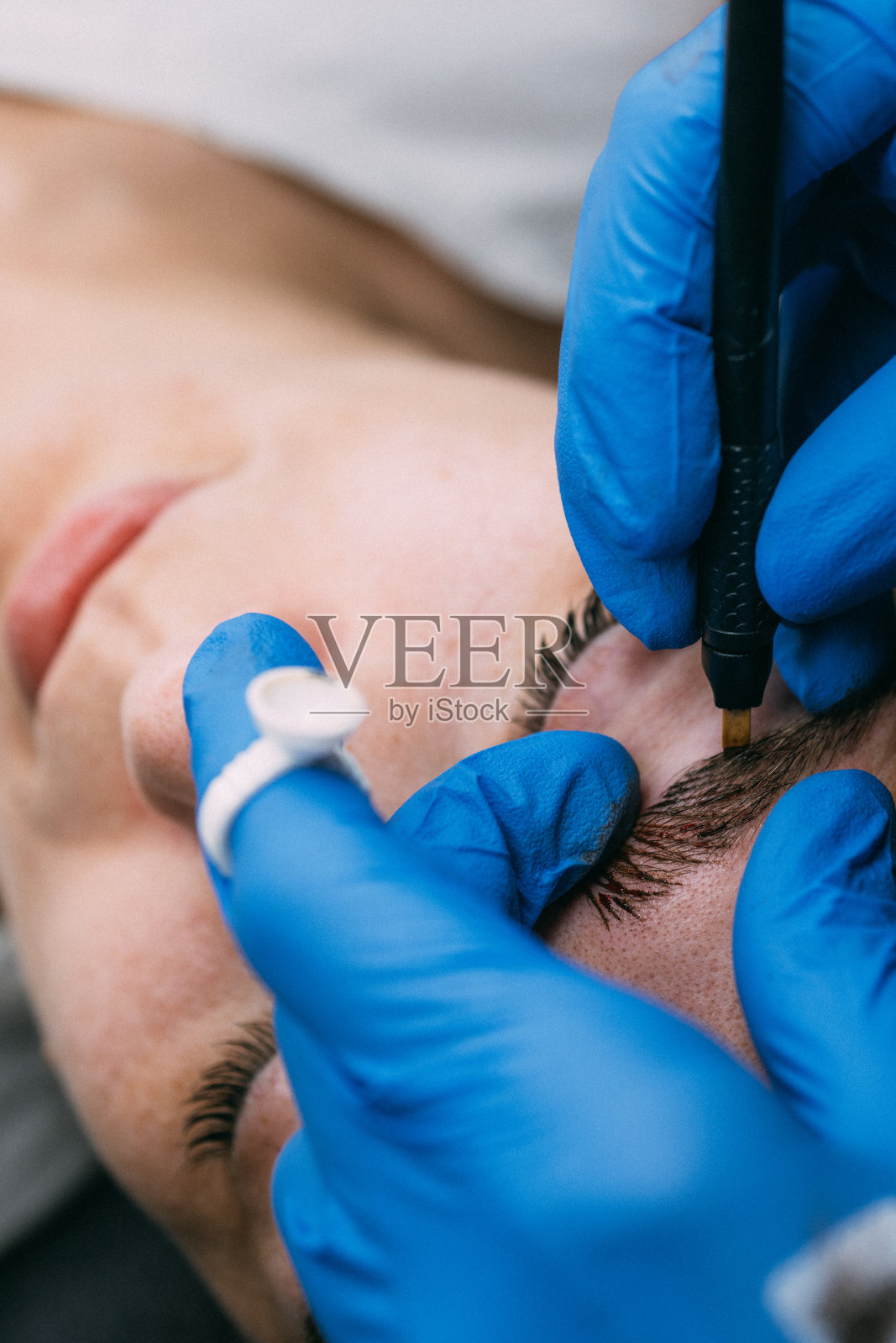 眉毛微刮刀手术照片摄影图片