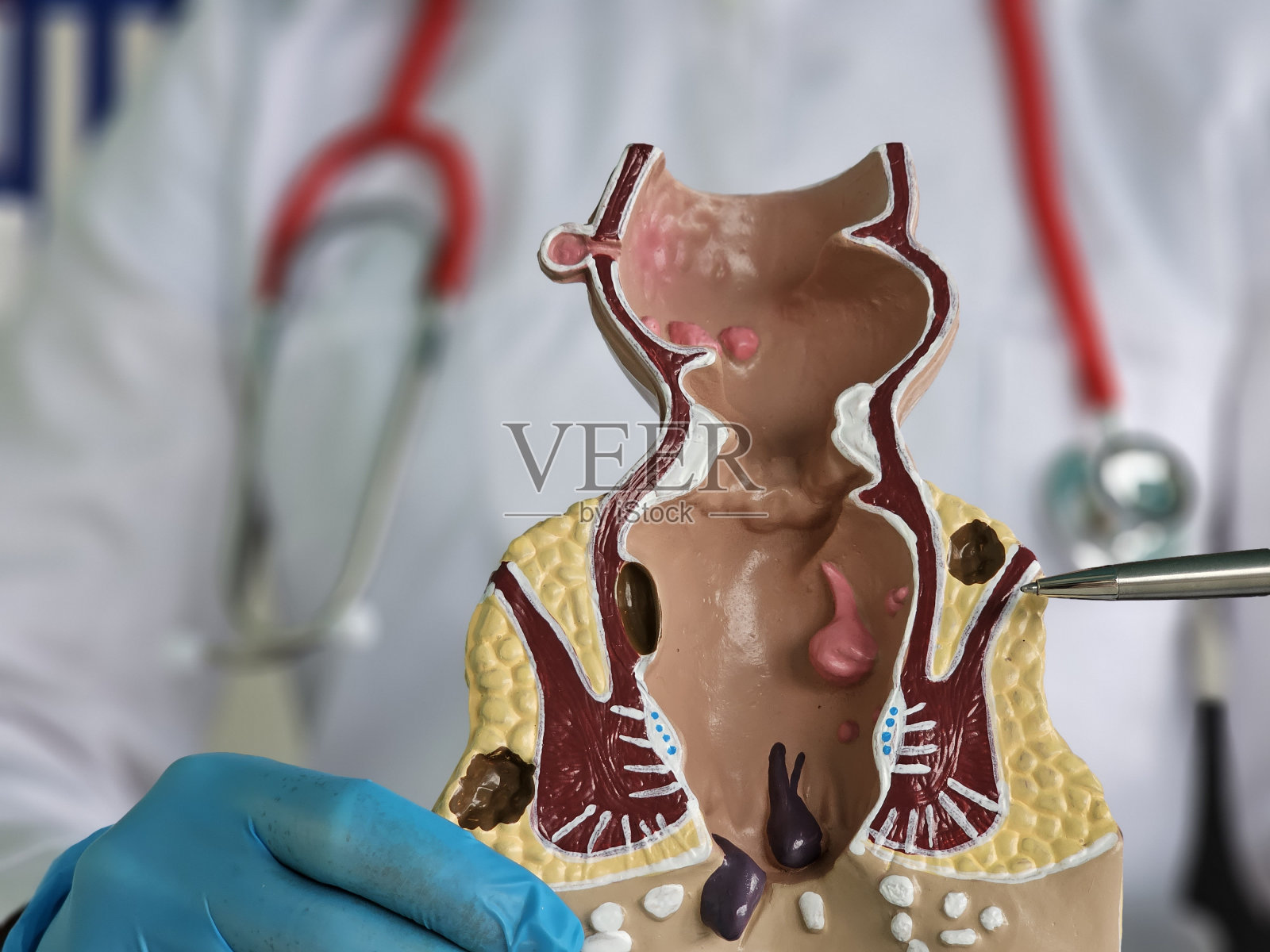 医生示范直肠和肛门的解剖模型照片摄影图片