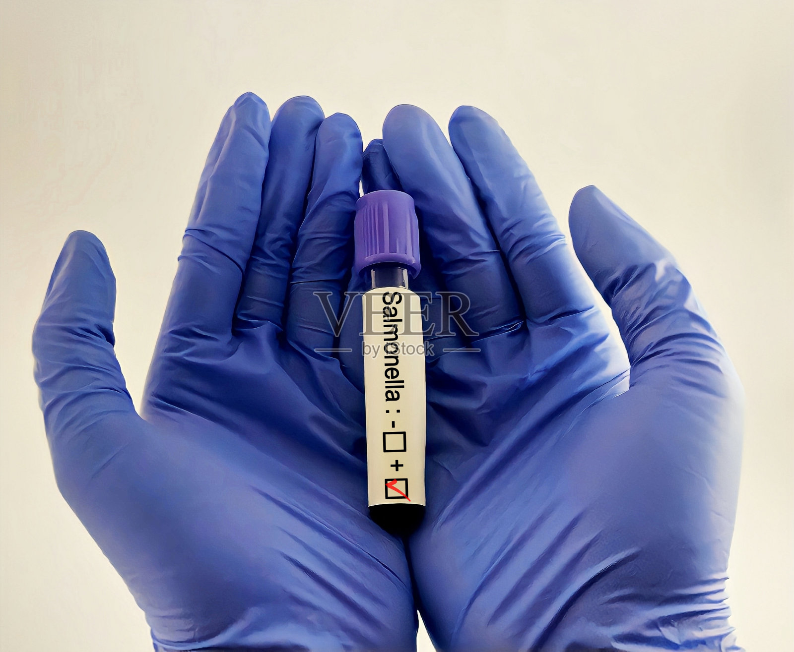 沙门氏菌检测呈阳性，诊断为伤寒。照片摄影图片