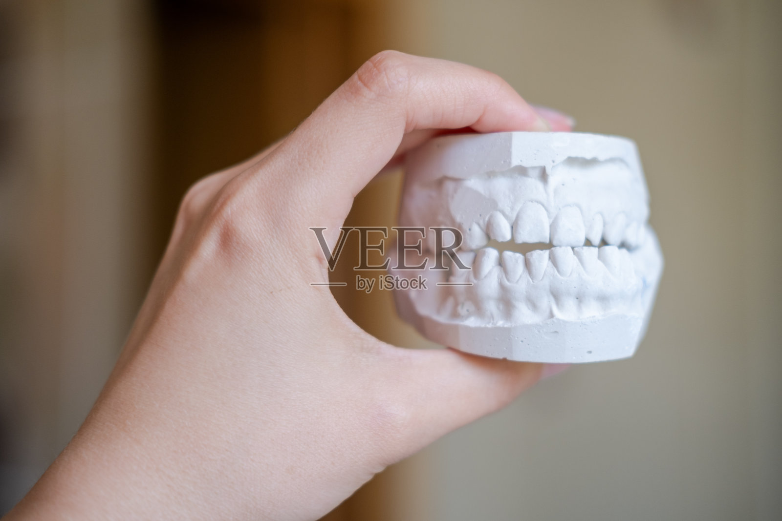 牙齿弯曲和错牙合的病人的牙颌的白色石膏印模。基于正畸印模的假牙和冠的制造照片摄影图片