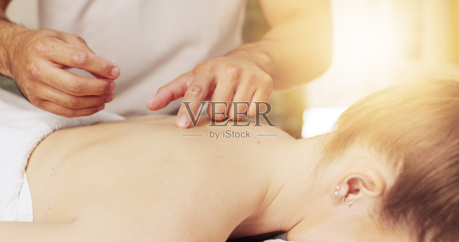 针灸，背部和手部水疗与客户治疗愈合，缓解压力或治疗。身体，干针和整体按摩师在度假化妆品，按摩和自然护肤照片摄影图片