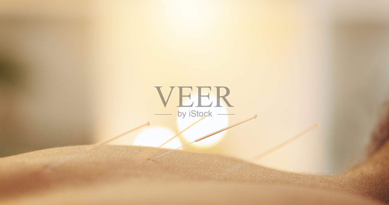 针灸，针和皮肤的健康水疗，替代药物或治疗疗法。放松，肌肉和身体疼痛在诊所的健康或压力治疗，支持免疫系统或损伤照片摄影图片