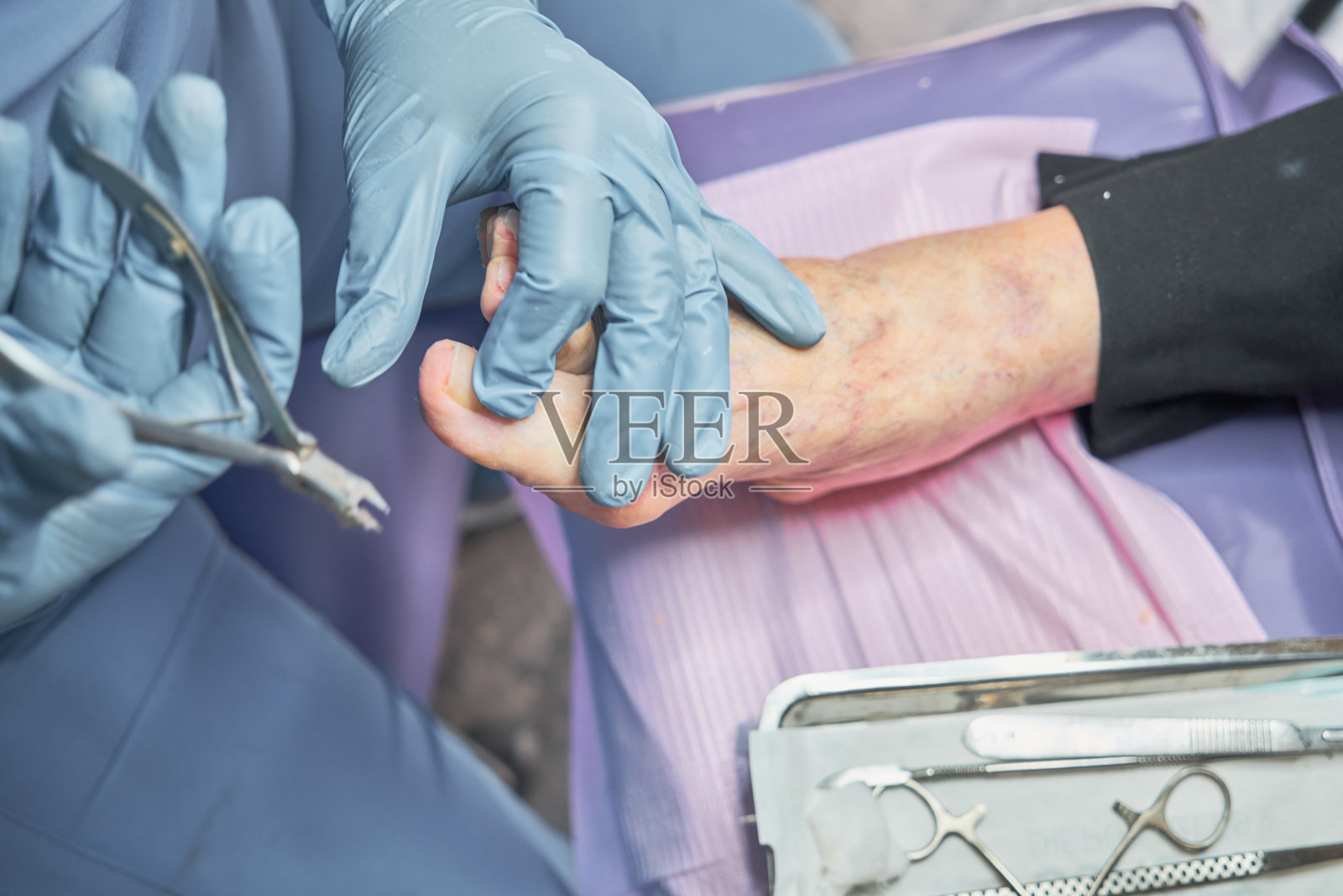 脚病医生给病人做足疗，清洗指甲照片摄影图片