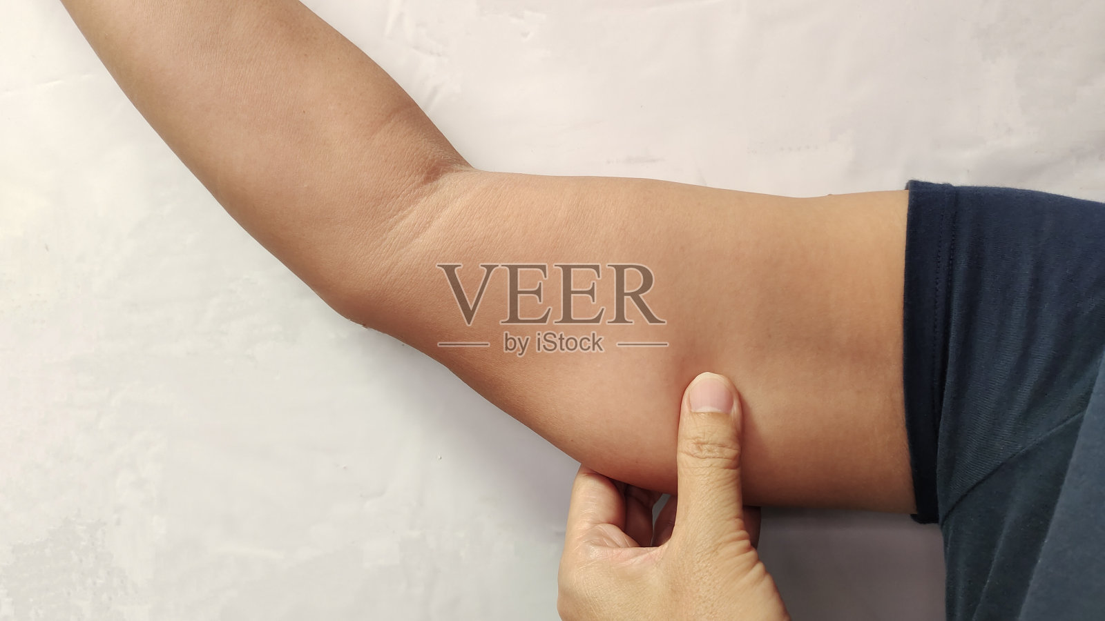 手臂上松弛的皮肤。照片摄影图片